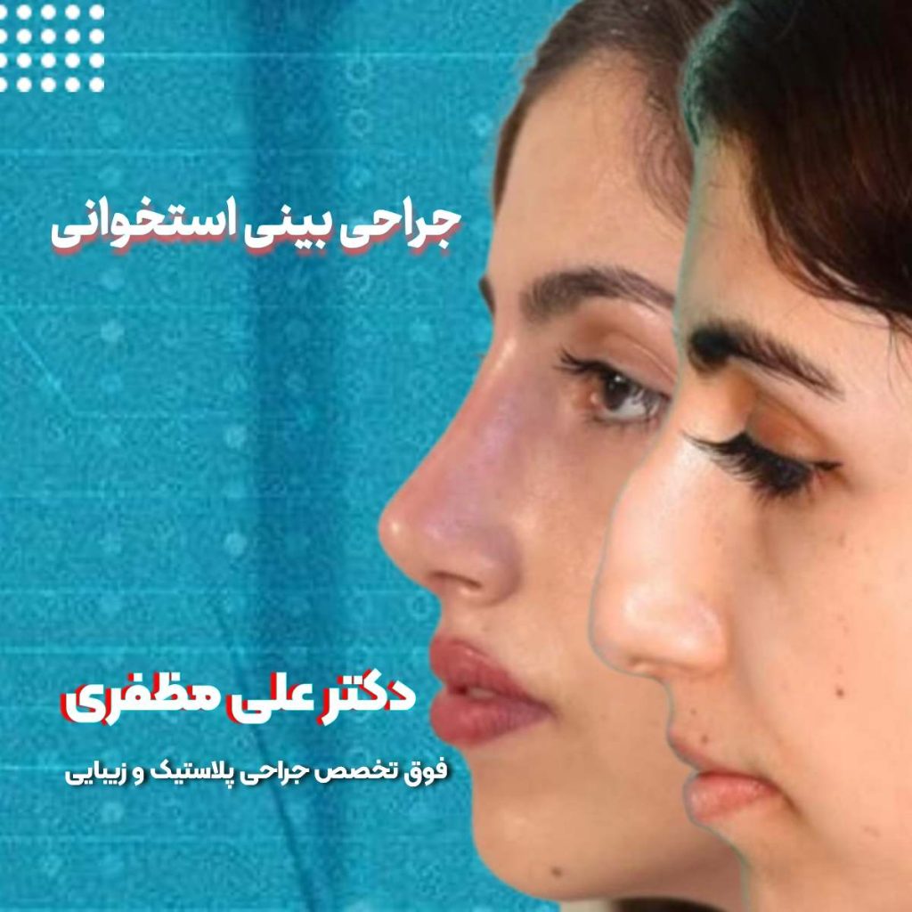 عمل بینی استخوانی در کرمانشاه | دکتر علی مظفری