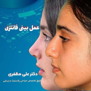 عمل بینی فانتزی در کرمانشاه | دکتر علی مظفری